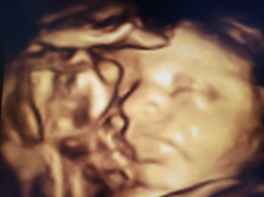 Medine Meltem Adalıoğlu-15