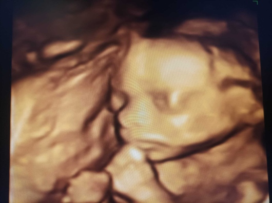 Medine Meltem Adalıoğlu-25