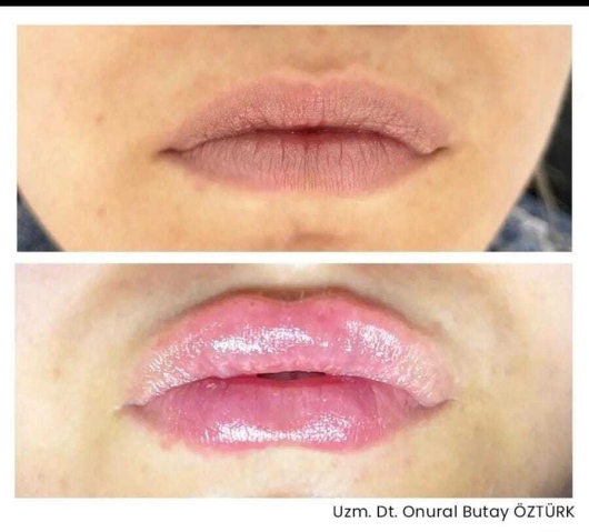 Onural Butay Öztürk-6