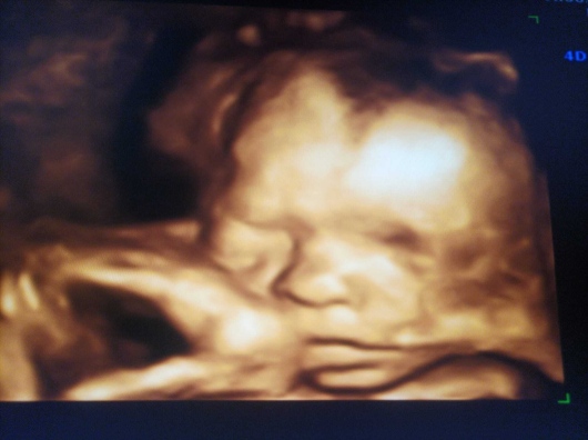 Medine Meltem Adalıoğlu-23