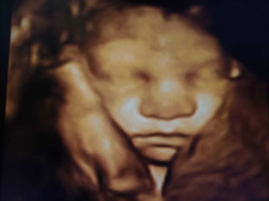 Medine Meltem Adalıoğlu-27