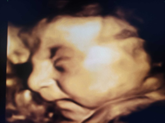 Medine Meltem Adalıoğlu-22