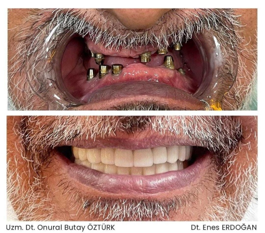 Onural Butay Öztürk-7