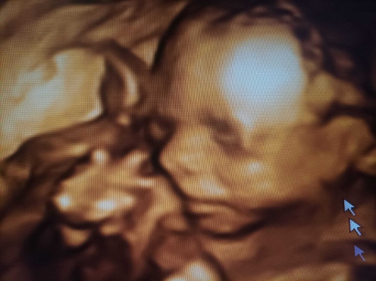 Medine Meltem Adalıoğlu-26