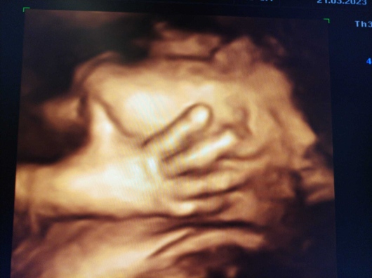 Medine Meltem Adalıoğlu-18