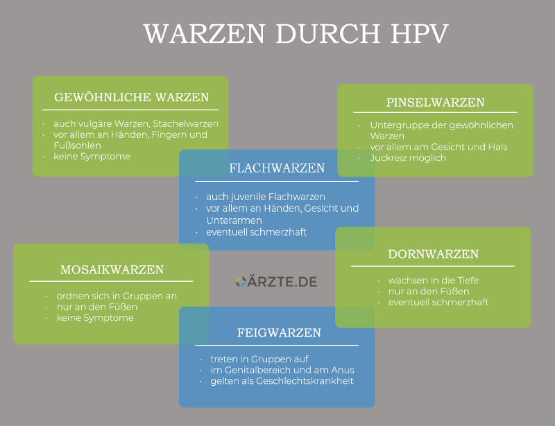 Warzenarten durch HPV