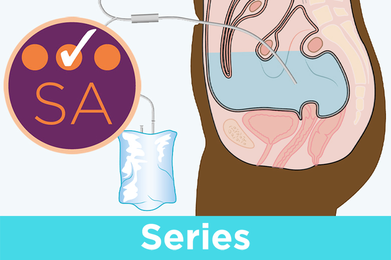 Renal system 4 causes, diagnosis and treatment of chronic kidney
