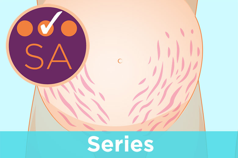 Pregnancy 3: effects on the musculoskeletal system and skin - Vimarsana News