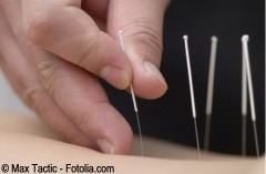 D acupuntura