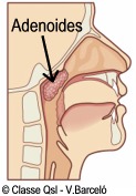 D adenoides