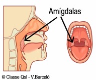 D amigdalas