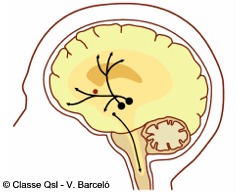 D cerebrodopamina