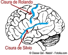 Resultado de imagen para cisura interhemisferica