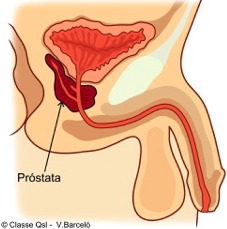 prostata definicion español prostata definicion español
