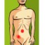 I apendicitis