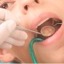 I caries2