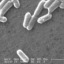 I escherichiacoli