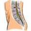 I herniadiscal