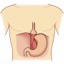I herniahiato