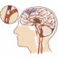 I ictus