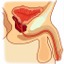 I prostata