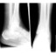 I radiografiatalon