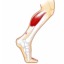 I tendinitis