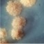 I tuberculosis