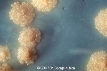 Tuberculosis, bacilo de Koch