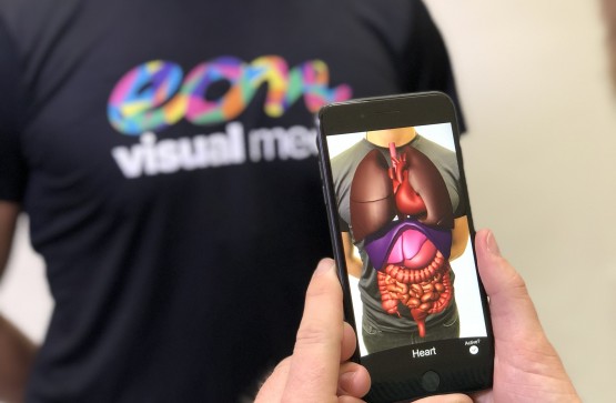 3 key benefits of augmented reality in the healthcare industry.