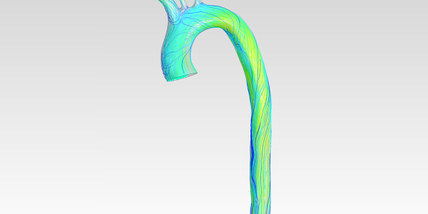 Human Aortic Arch CFD Analysis - Downloads: 0, Views: 4, Likes: 0