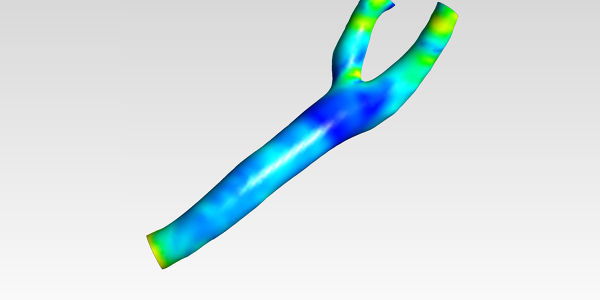 Carotid Bifurcation CFD Analysis - Downloads: 0, Views: 13, Likes: 0