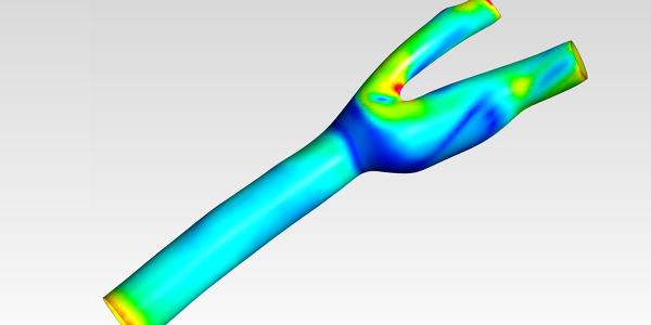 Carotid bifurcation cfd simulation - Downloads: 0, Views: 25, Likes: 0
