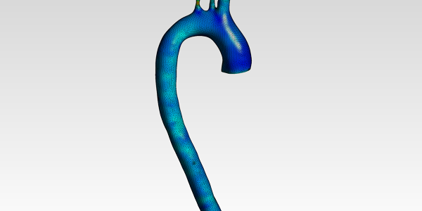 Human Aortic Arch CFD Analysis - Downloads: 0, Views: 87, Likes: 0