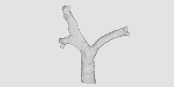 Human Trachea CAD - Downloads: 0, Views: 0, Likes: 0