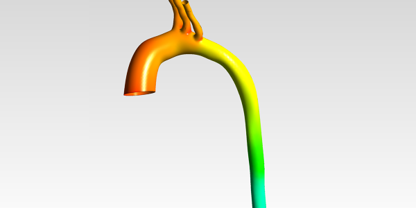 Patient-Specific Aortic Arch CFD Analysis - Downloads: 0, Views: 26, Likes: 0