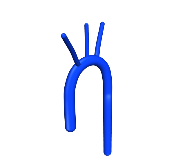 Human-Aortic-Arch-CAD-Model-FetchCFD-Image.PNG - High-quality image for the Human Aortic Arch CAD Model project
