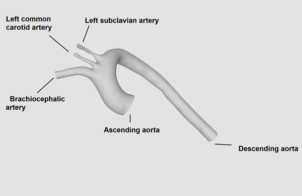Human-Aortic-Arch-CAD-Model-FetchCFD-Image.png - High-quality image for the Human Aortic Arch CAD Model project