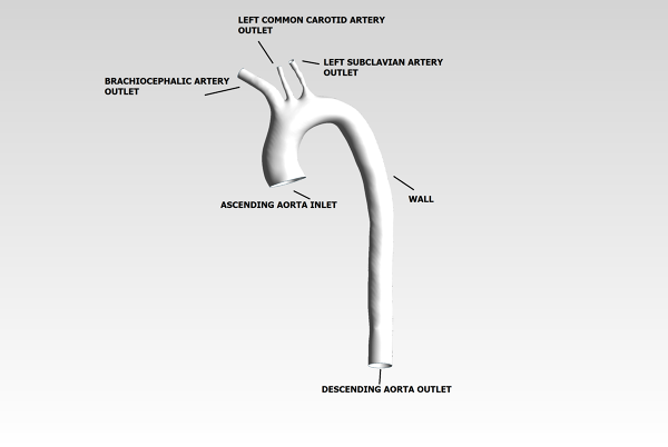 Human-Aortic-Arch-CFD-Analysis-Boundary-Conditions-FetchCFD-Image.png - High-quality image for the Human Aortic Arch CFD Analysis project