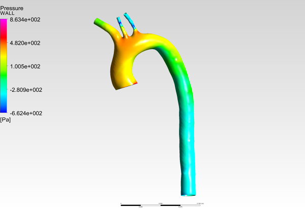 Human-Aortic-Arch-CFD-Analysis-Pressure-Contour-FetchCFD-Image.PNG - High-quality image for the Human Aortic Arch CFD Analysis project