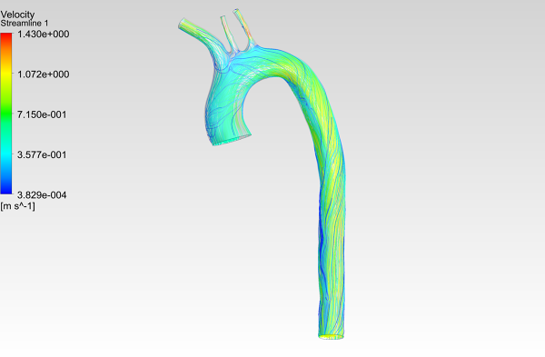 Human-Aortic-Arch-CFD-Analysis-Velocity-Streamlines-FetchCFD-Image.PNG - High-quality image for the Human Aortic Arch CFD Analysis project