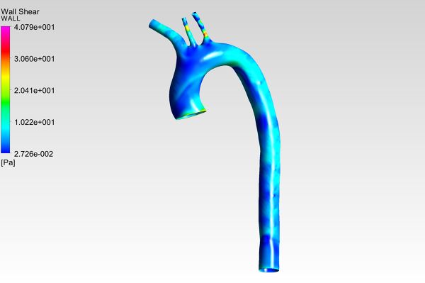 Human-Aortic-Arch-CFD-Analysis-Wall-Shear-Stress-Contour-FetchCFD-Image.PNG - High-quality image for the Human Aortic Arch CFD Analysis project