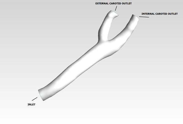 Human-Carotid-Bifurcation-CFD-Analysis-Boundary-Conditions-FetchCFD-Image.png - High-quality image for the Carotid Bifurcation CFD Analysis project