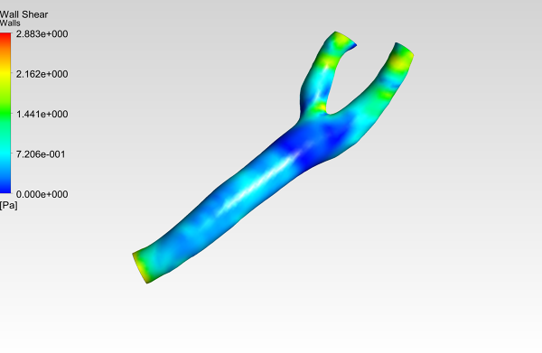 Human-Carotid-Bifurcation-CFD-Analysis-Wall-Shear-Stress-Contour-FetchCFD-Image.PNG - High-quality image for the Carotid Bifurcation CFD Analysis project