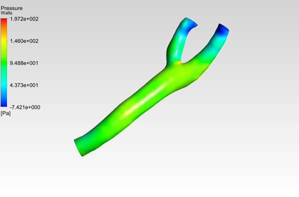 Human-Carotid-Bifurcation-CFD-Analysis-Pressure-Contour-FetchCFD-Image.PNG - High-quality image for the Carotid Bifurcation CFD Analysis project