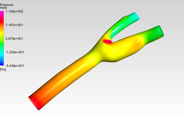 Human-Carotid-Artery-Bifurcation-CFD-Simulation-Pressure-Contour-FetchCFD-Image.PNG - High-quality image for the Carotid bifurcation cfd simulation project