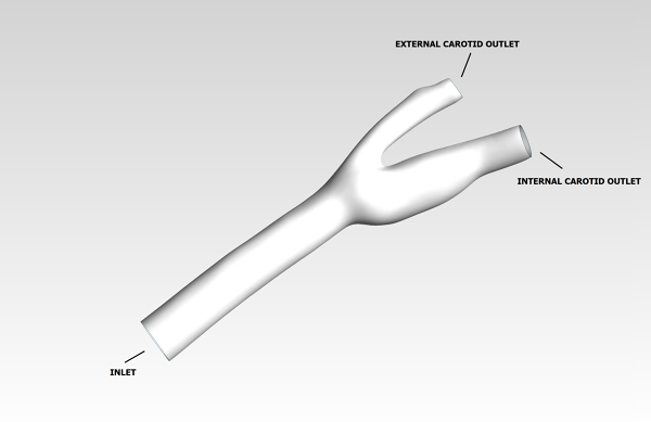 Human-Carotid-Bifurcation-2-CFD-Analysis-Boundary-Conditions-FetchCFD-Image.png - High-quality image for the Carotid bifurcation cfd simulation project