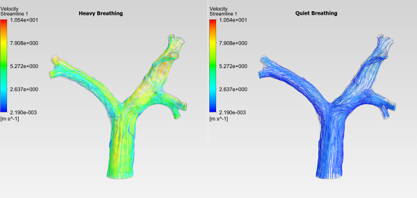 Human-Trachea-CFD-Analysis-Velocity-Streamlines-Heavy-vs-Quiet-Breathing-Comparison-FetchCFD-Image.png - High-quality image for the Human Trachea CFD Analysis project