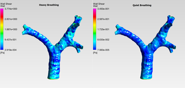 Human-Trachea-CFD-Analysis-WSS-Contour-Heavy-vs-Quiet-Breathing-Comparison-FetchCFD-Image.png - High-quality image for the Human Trachea CFD Analysis project