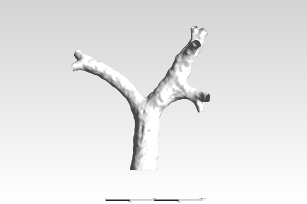 Human-Trachea-CAD-Model-FetchCFD-Image-View-1.PNG - High-quality image for the Human Trachea CAD project